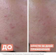 AVENE CLEANANCE Сыворотка обновляющая для жирной и комбинированной кожи, 30мл