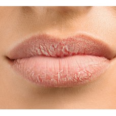 VITAMINDERMINA Помада для губ восстанавливающая, 4,5мл